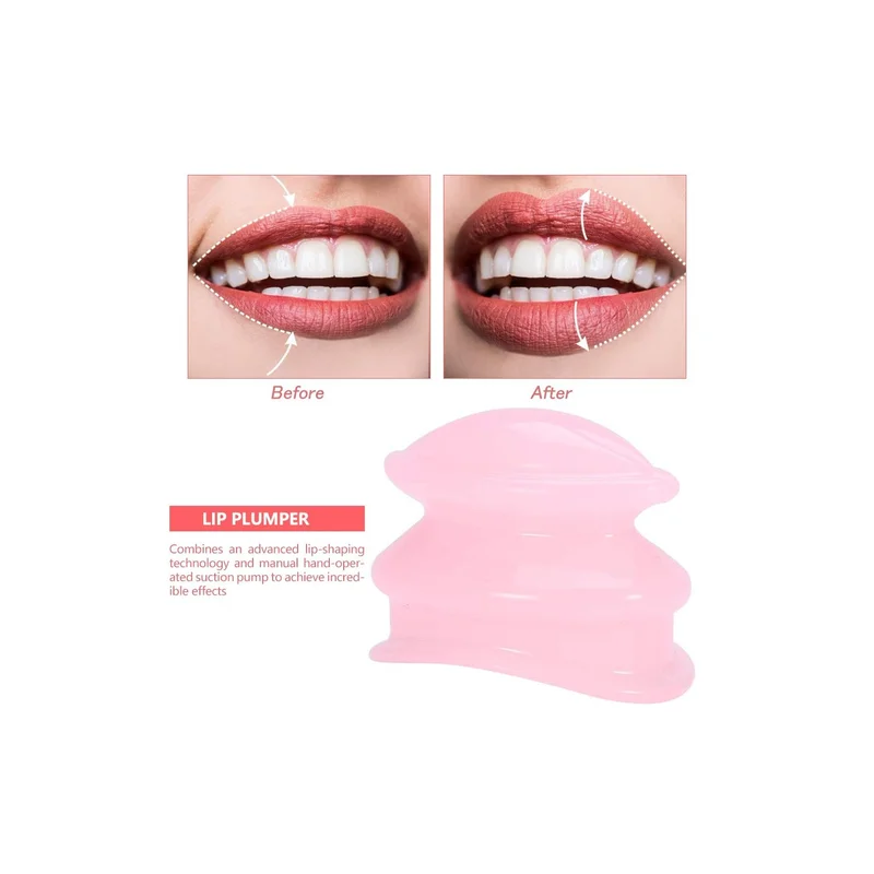 ibspot-24986960